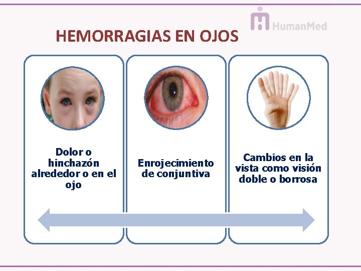 HEMORRAGIAS EN OJOS Dolor o hinchazón alrededor o en el ojo Enrojecimiento de conjuntiva