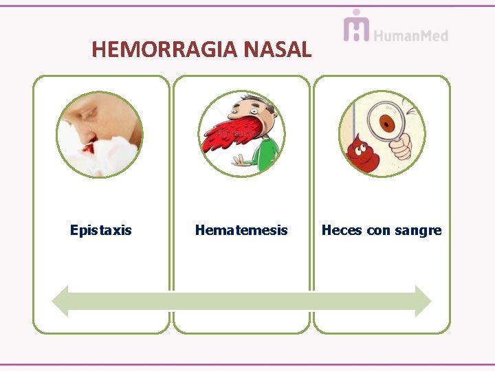 HEMORRAGIA NASAL Epistaxis Hematemesis Heces con sangre 