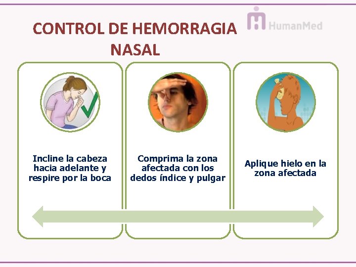 CONTROL DE HEMORRAGIA NASAL Incline la cabeza hacia adelante y respire por la boca