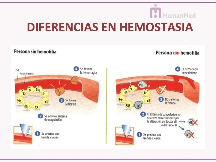 DIFERENCIAS EN HEMOSTASIA 