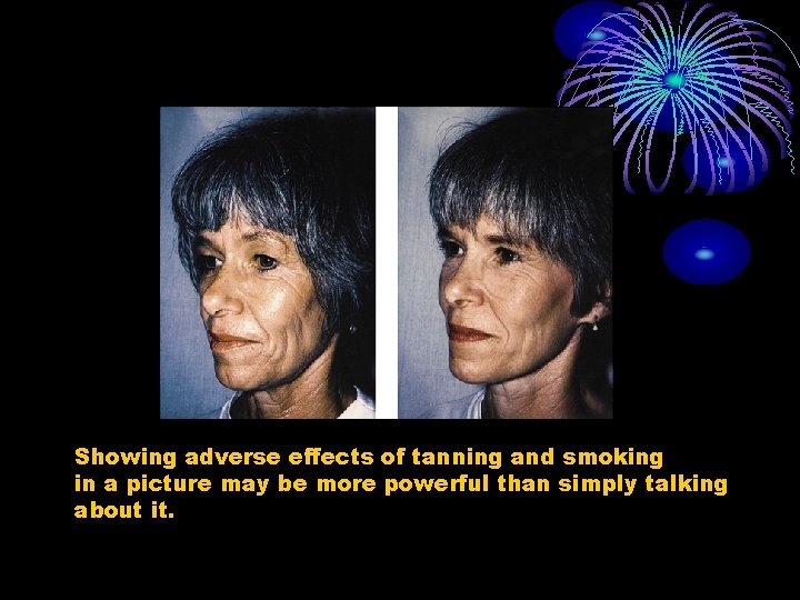 Showing adverse effects of tanning and smoking in a picture may be more powerful Showing adverse effects of tanning and smoking in a picture may be more powerful