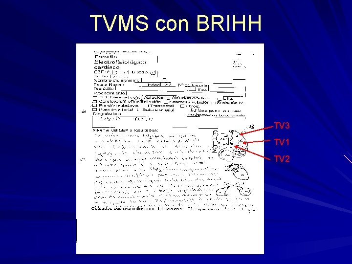TVMS con BRIHH TV 3 TV 1 TV 2 TVMS con BRIHH TV 3 TV 1 TV 2