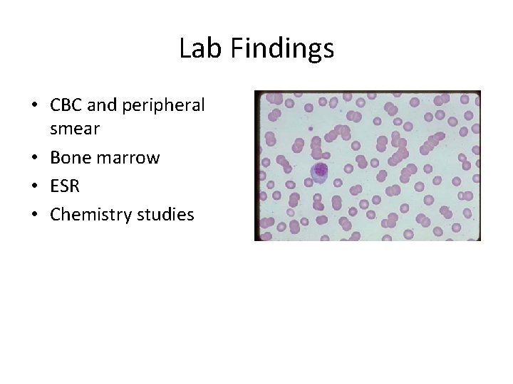 Lab Findings • CBC and peripheral smear • Bone marrow • ESR • Chemistry