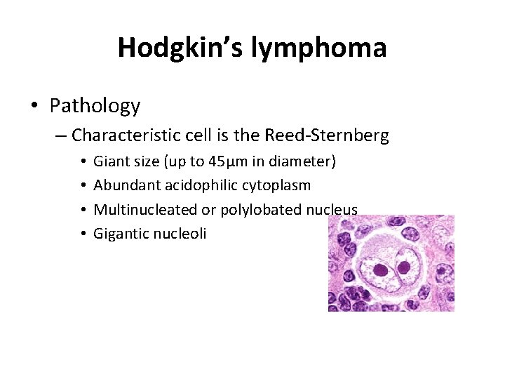 Hodgkin’s lymphoma • Pathology – Characteristic cell is the Reed-Sternberg • • Giant size