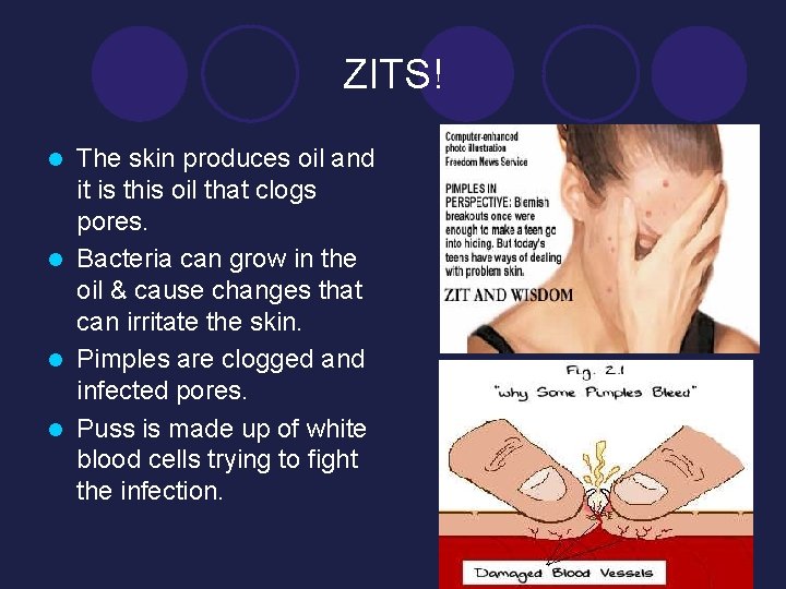 ZITS! The skin produces oil and it is this oil that clogs pores. l