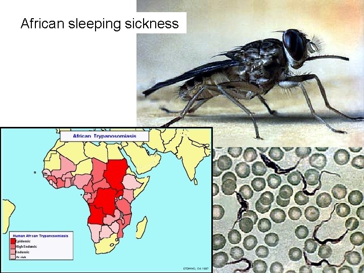 African sleeping sickness 
