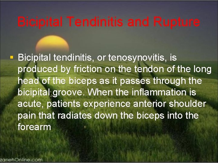 Bicipital Tendinitis and Rupture § Bicipital tendinitis, or tenosynovitis, is produced by friction on