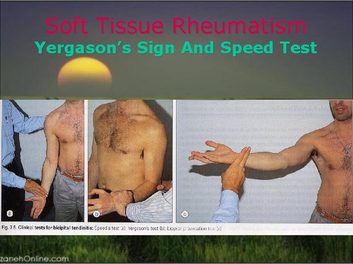 Soft Tissue Rheumatism Yergason’s Sign And Speed Test 