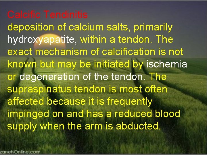 Calcific Tendinitis deposition of calcium salts, primarily hydroxyapatite, within a tendon. The exact mechanism