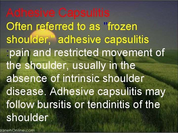 Adhesive Capsulitis Often referred to as "frozen shoulder, " adhesive capsulitis : pain and