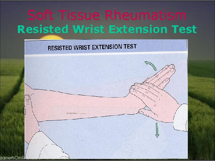 Soft Tissue Rheumatism Resisted Wrist Extension Test 