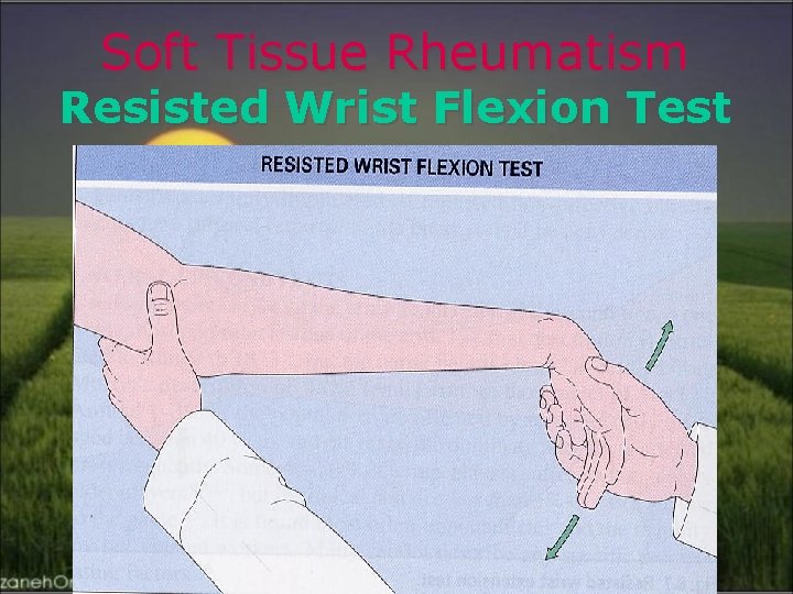 Soft Tissue Rheumatism Resisted Wrist Flexion Test 