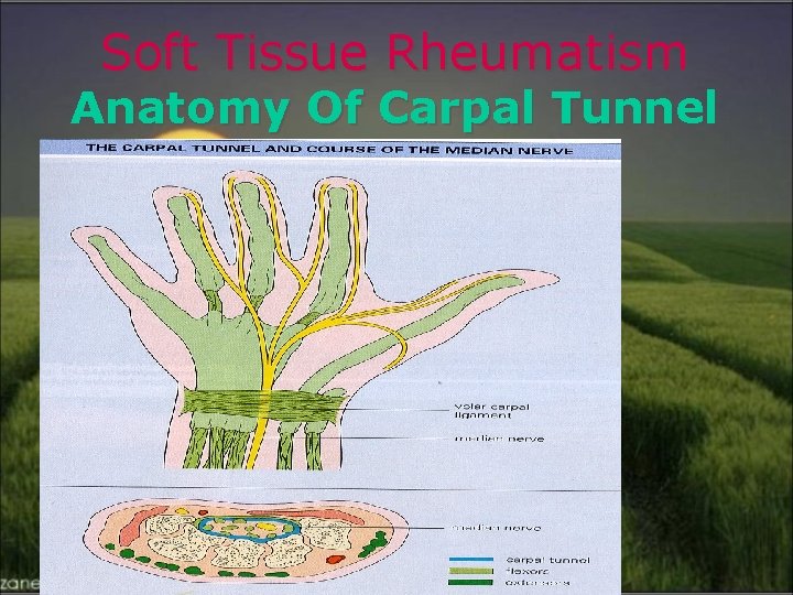 Soft Tissue Rheumatism Anatomy Of Carpal Tunnel 