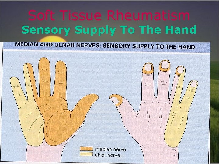 Soft Tissue Rheumatism Sensory Supply To The Hand 