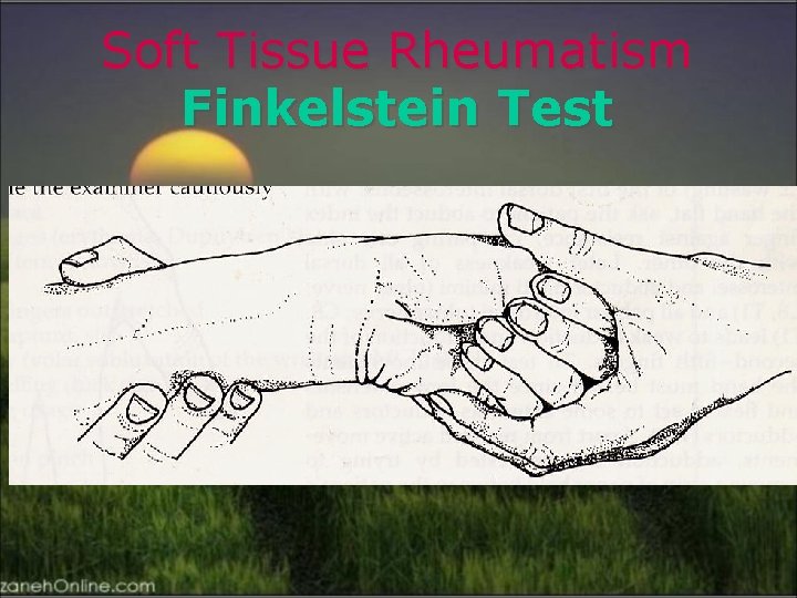 Soft Tissue Rheumatism Finkelstein Test 