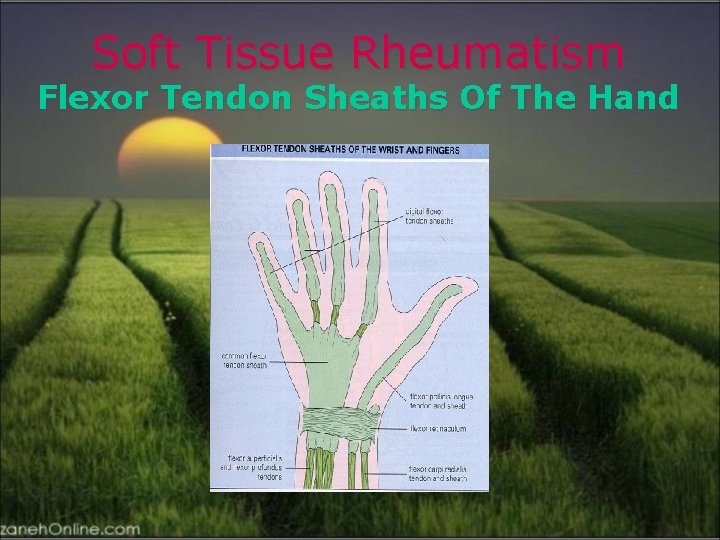 Soft Tissue Rheumatism Flexor Tendon Sheaths Of The Hand 