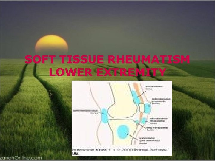 SOFT TISSUE RHEUMATISM LOWER EXTREMITY 