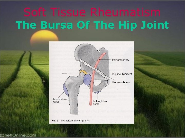 Soft Tissue Rheumatism The Bursa Of The Hip Joint 