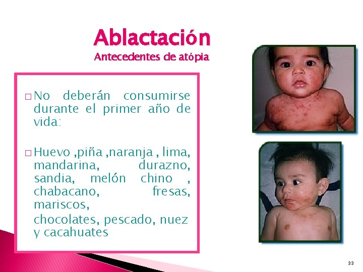 Ablactación Antecedentes de atópia � No deberán consumirse durante el primer año de vida: