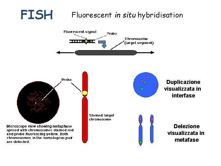 FISH Fluorescent in situ hybridisation Duplicazione visualizzata in interfase Delezione visualizzata in metafase 