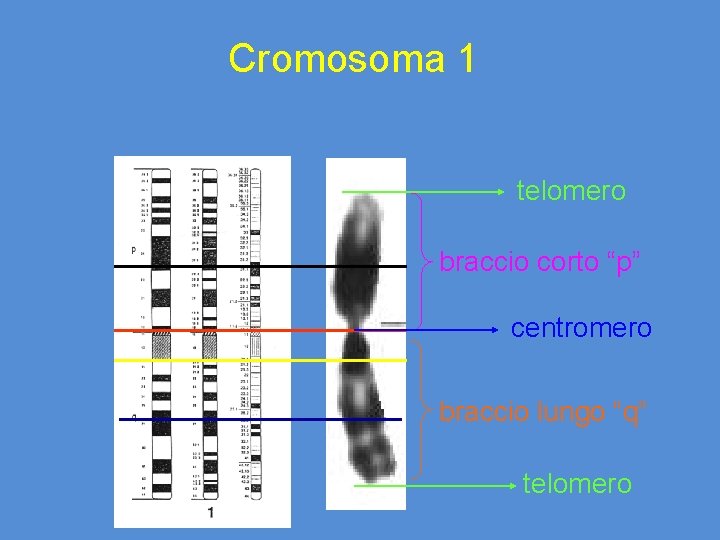 Cromosoma 1 telomero braccio corto “p” centromero braccio lungo “q” telomero 