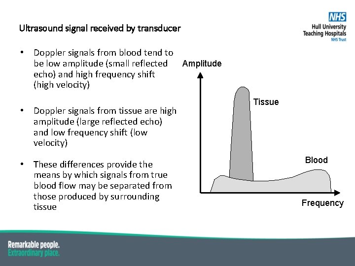 Ultrasound signal received by transducer • Doppler signals from blood tend to be low