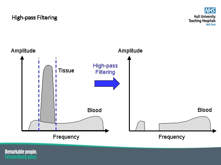 High-pass Filtering Amplitude Tissue High-pass Filtering Blood Frequency 