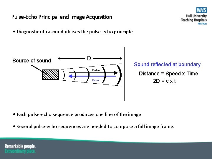 Pulse-Echo Principal and Image Acquisition • Diagnostic ultrasound utilises the pulse-echo principle D Source