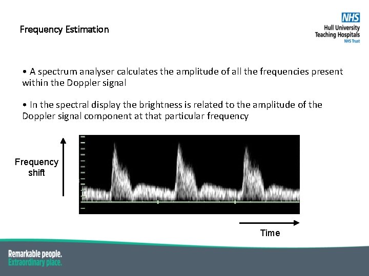 Frequency Estimation • A spectrum analyser calculates the amplitude of all the frequencies present