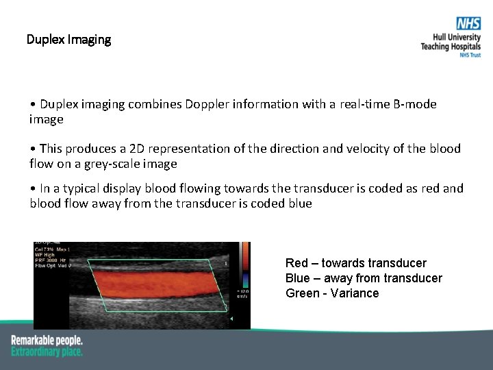 Duplex Imaging • Duplex imaging combines Doppler information with a real-time B-mode image •