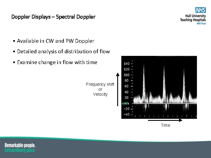 Doppler Displays – Spectral Doppler • Available in CW and PW Doppler • Detailed