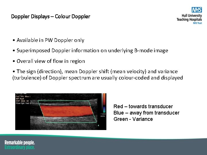 Doppler Displays – Colour Doppler • Available in PW Doppler only • Superimposed Doppler