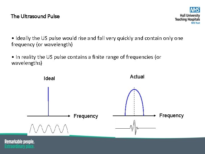 The Ultrasound Pulse • Ideally the US pulse would rise and fall very quickly