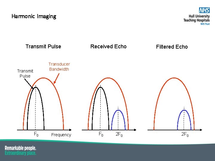 Harmonic Imaging Transmit Pulse Received Echo Filtered Echo Transducer Bandwidth Transmit Pulse F 0