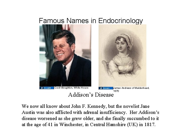 Famous Names in Endocrinology Cecil Stoughton, White House James Andrews of Maidenhead, 1870 Addison’s