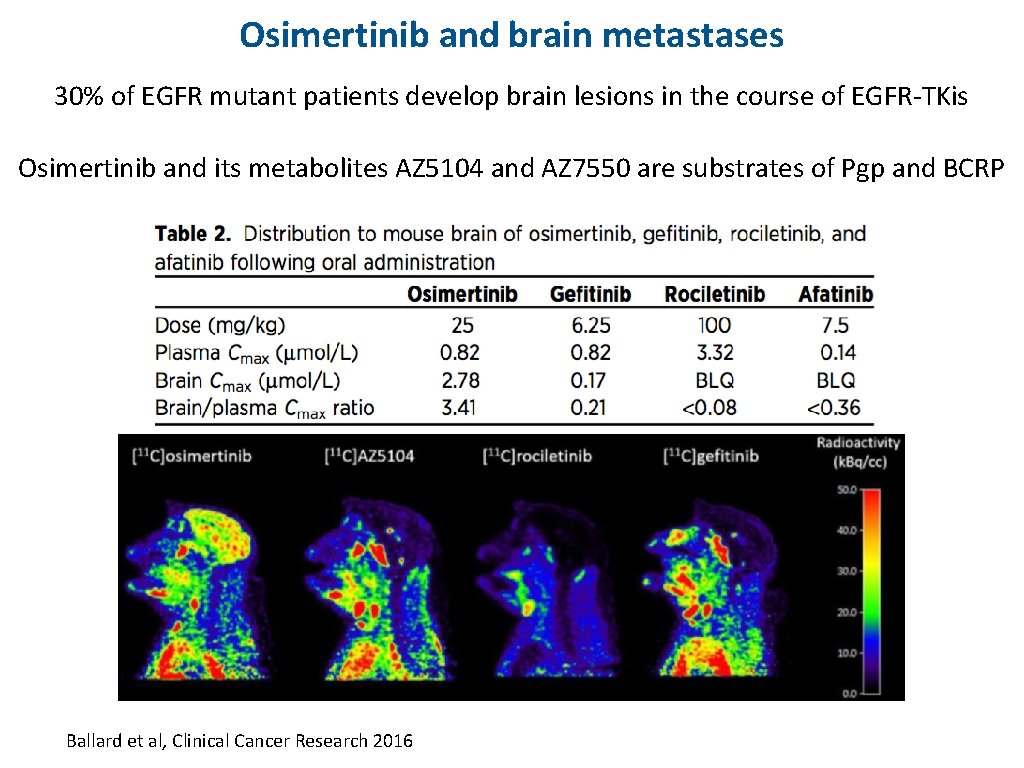 Osimertinib and brain metastases 30% of EGFR mutant patients develop brain lesions in the