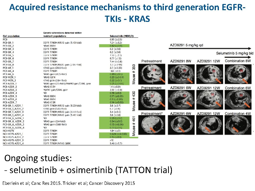 Acquired resistance mechanisms to third generation EGFRTKIs - KRAS Ongoing studies: - selumetinib +