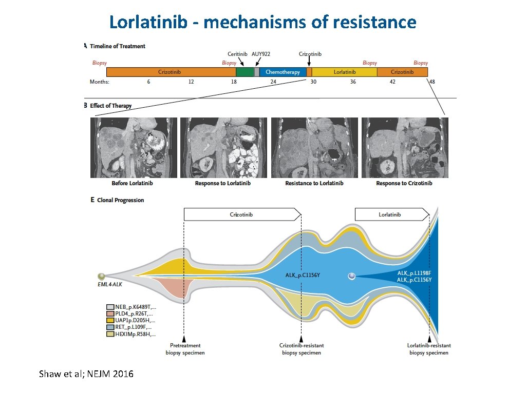 Lorlatinib - mechanisms of resistance Shaw et al; NEJM 2016 