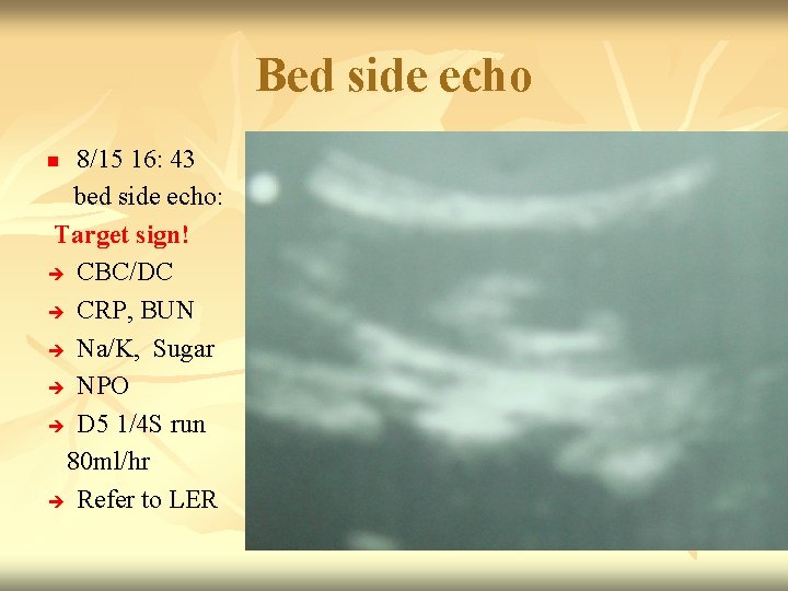 Bed side echo 8/15 16: 43 bed side echo: Target sign! CBC/DC CRP, BUN