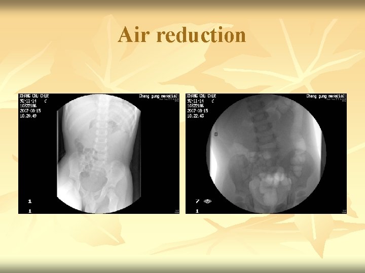 Air reduction 
