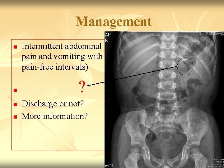 Management n n Intermittent abdominal pain and vomiting with pain-free intervals) ? Discharge or