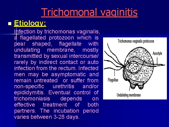 Trichomonal vaginitis n Etiology: Infection by trichomonas vaginalis, a flagellated protozoon which is pear