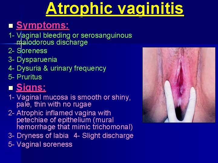 Atrophic vaginitis n Symptoms: 1 Vaginal bleeding or serosanguinous malodorous discharge 2 Soreness 3