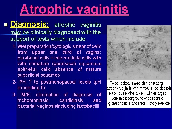 Atrophic vaginitis n Diagnosis: atrophic vaginitis may be clinically diagnosed with the support of