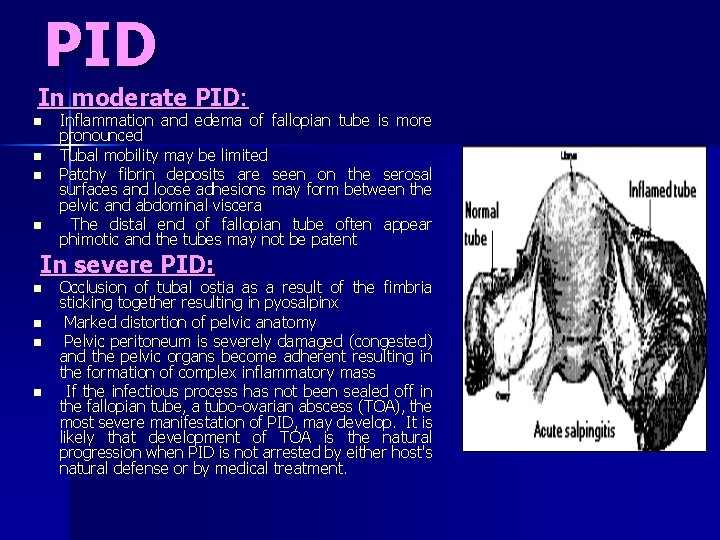 PID In moderate PID: n n Inflammation and edema of fallopian tube is more