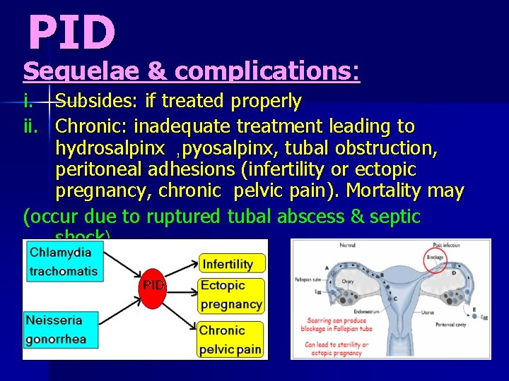 PID Sequelae & complications: i. Subsides: if treated properly ii. Chronic: inadequate treatment leading