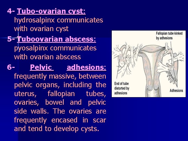 4 - Tubo-ovarian cyst: hydrosalpinx communicates with ovarian cyst 5 - Tuboovarian abscess: pyosalpinx