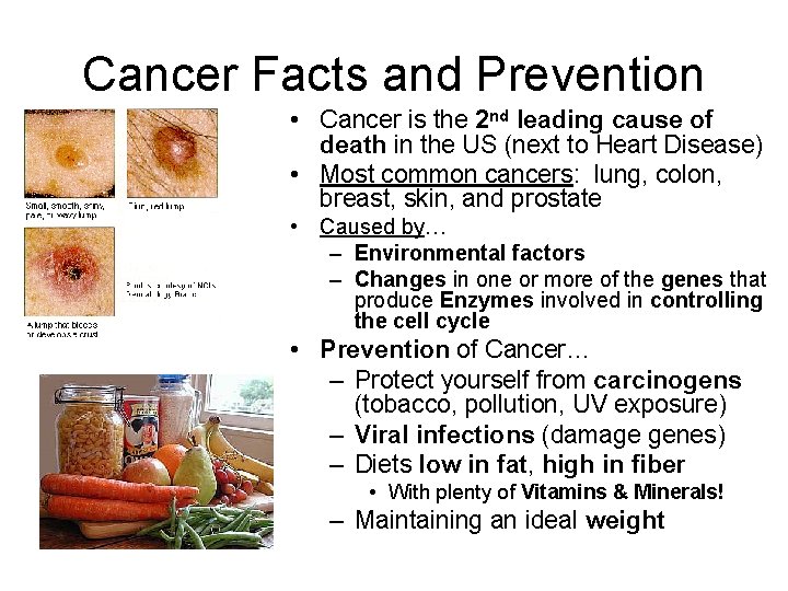 Cancer Facts and Prevention • Cancer is the 2 nd leading cause of death
