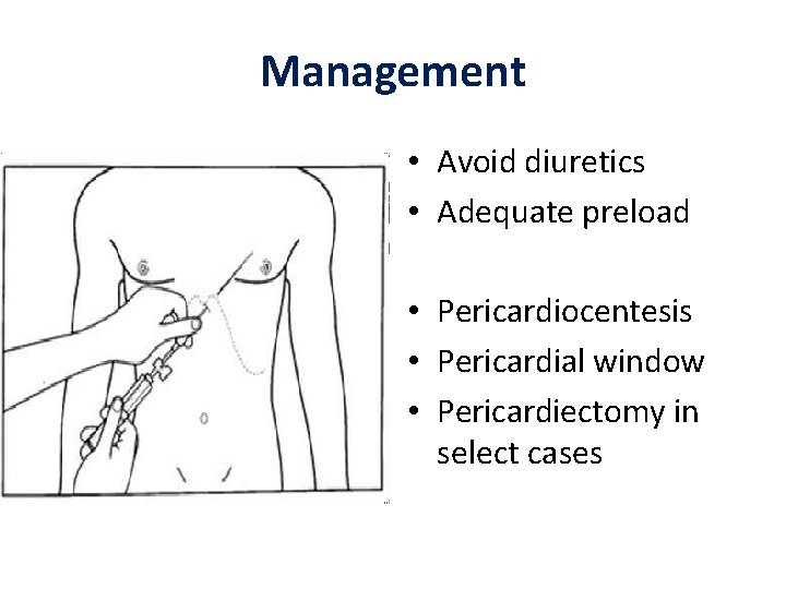 Management • Avoid diuretics • Adequate preload • Pericardiocentesis • Pericardial window • Pericardiectomy