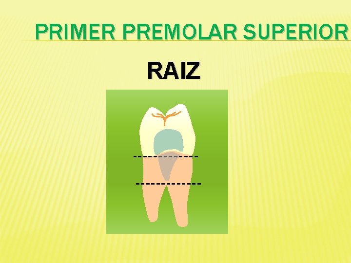 PRIMER PREMOLAR SUPERIOR RAIZ 